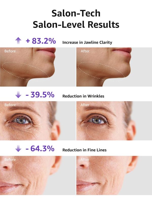 Skin Tightening Face Machine, Facial Massager Light Therapy for Face, 3 in 1 Microcurrent Facial Device Home Use Anti-Aging Device, 5 Level for Facial Firming, Wrinkle, Lifting, Toning, Glow Boost