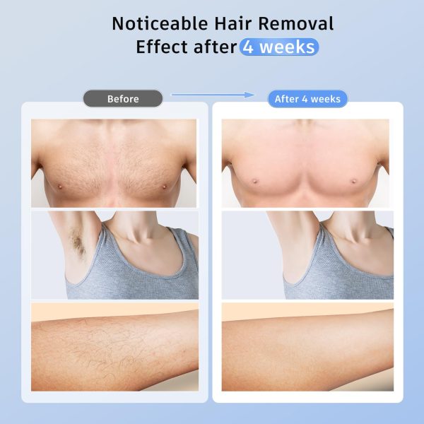 71Cu7ybegeL Laser Hair Removal Ubroo IPL Hair Removal Device with 5℃ Ice Cooling, 3 In 1 Painless Hair Removal For Women Men Permanent Face Body Beauty Care (Gold)