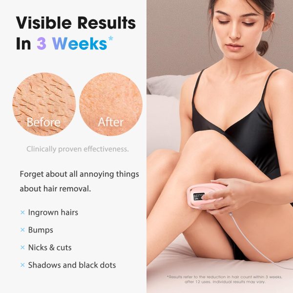 71GqpV6cwRL IPL Laser Hair Removal Device for Women & Men - Home 45°F Ice-Cooling Contact for Painless & Long-Lasting Results, 86% Hair Reduction in 3 Weeks for Full Body & Bikini Line, Rose Gold