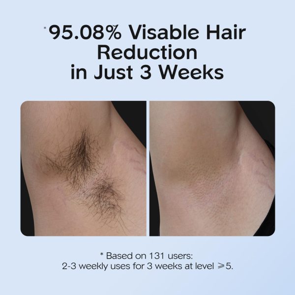 71LRn12XLUL INNZA IPL Hair Removal with Ice Cooling Care Function for Women,Long-Lasting Results,999,999 Flashes Painless Hair Removal, Hair Removal Device for Armpits Legs Arms Bikini Line