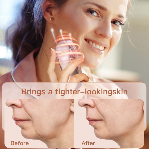 Radio Frequency Face Device | RF Professional 10 Watts | Electric | Firm Skin | Increase Collagen | Wrinkle Reducing | Anti Aging - Portable at Home Skin Care Face Beauty Device