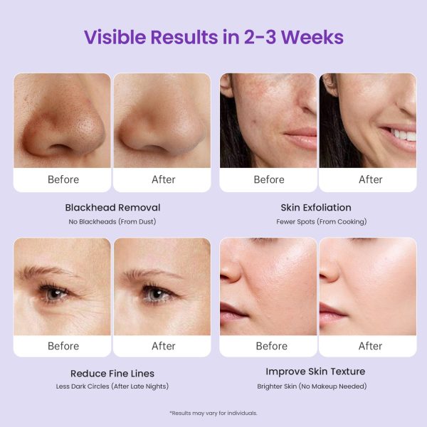 71nhUM2ZBWL Diamond Microdermabrasion Machine Professional, 3 in 1 Dermabrasion Facial Peeling Skin Care Device for Salon Personal Home Use