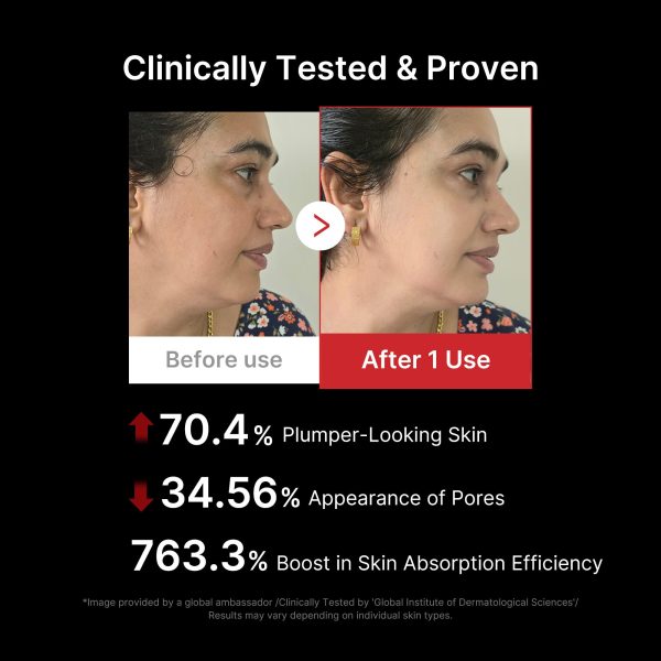 71tGT86s2bnL medicube Age-R Booster Pro | 6-in-1 Real Glass Glow Beauty Massager | Looking Glass Skin | Korean Skin Care