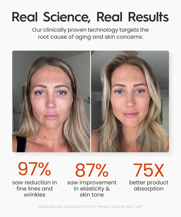 81ELVt2bD8oL Genie | 3-in-1 Face & Neck Beauty Massager with Heat, 3 Light Therapies, Smart Vibration | Red Light, Blue Light, Green Light Therapy for Wrinkles, Hyperpigmentation, Acne & More - Beige