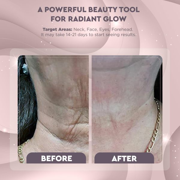 81q5bzdfpNL GLO24K Red Light Face & Neck Beauty Device – 3-in-1 Facial Massager Tool with LED & Vibration for Skin Revitalization and Neck Firming