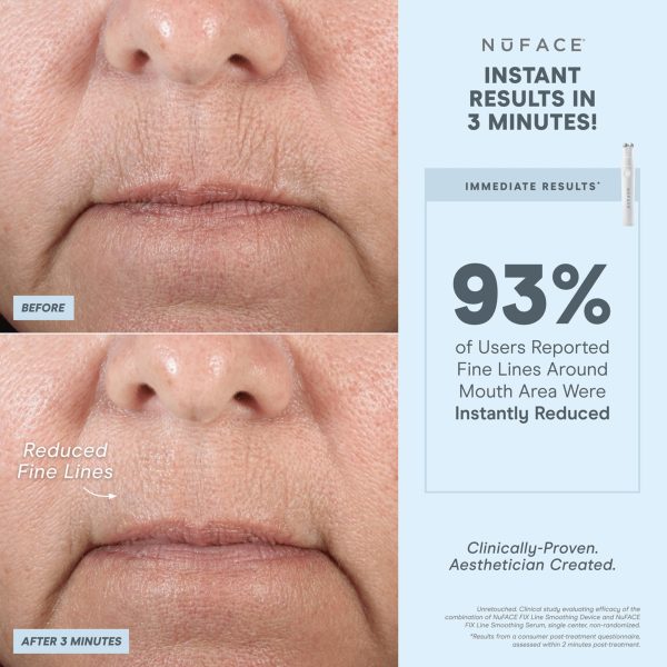 NuFACE FIX MicroWand Microcurrent Facial Device, FDA Cleared - Eyes, Lips & Lines Treatment with Serum Activator - Lip Plumper, Eye Depuffing Wand, Wrinkle & Smile Line Reducer, 3 On-The-Go Modes